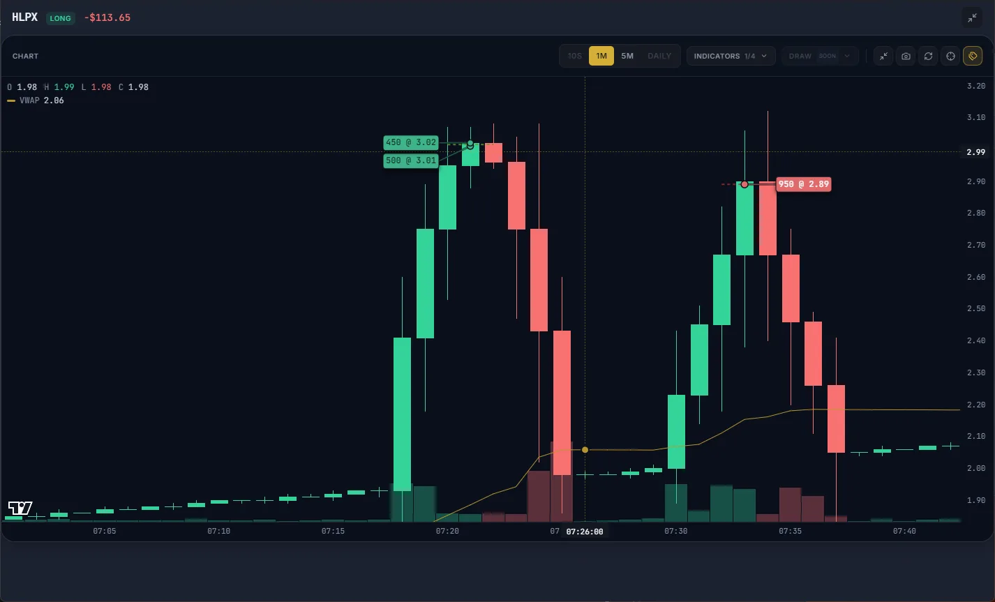 A losing trade on the chart with VWAP visible (demo data)
